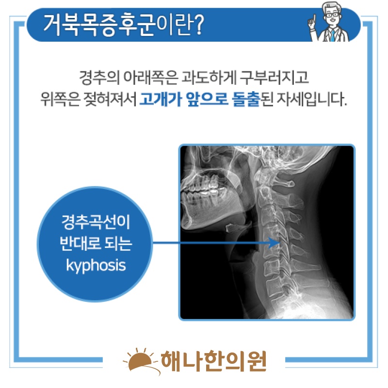 거북목증후군으로 이어지는 목 뒤쪽 통증의 양상