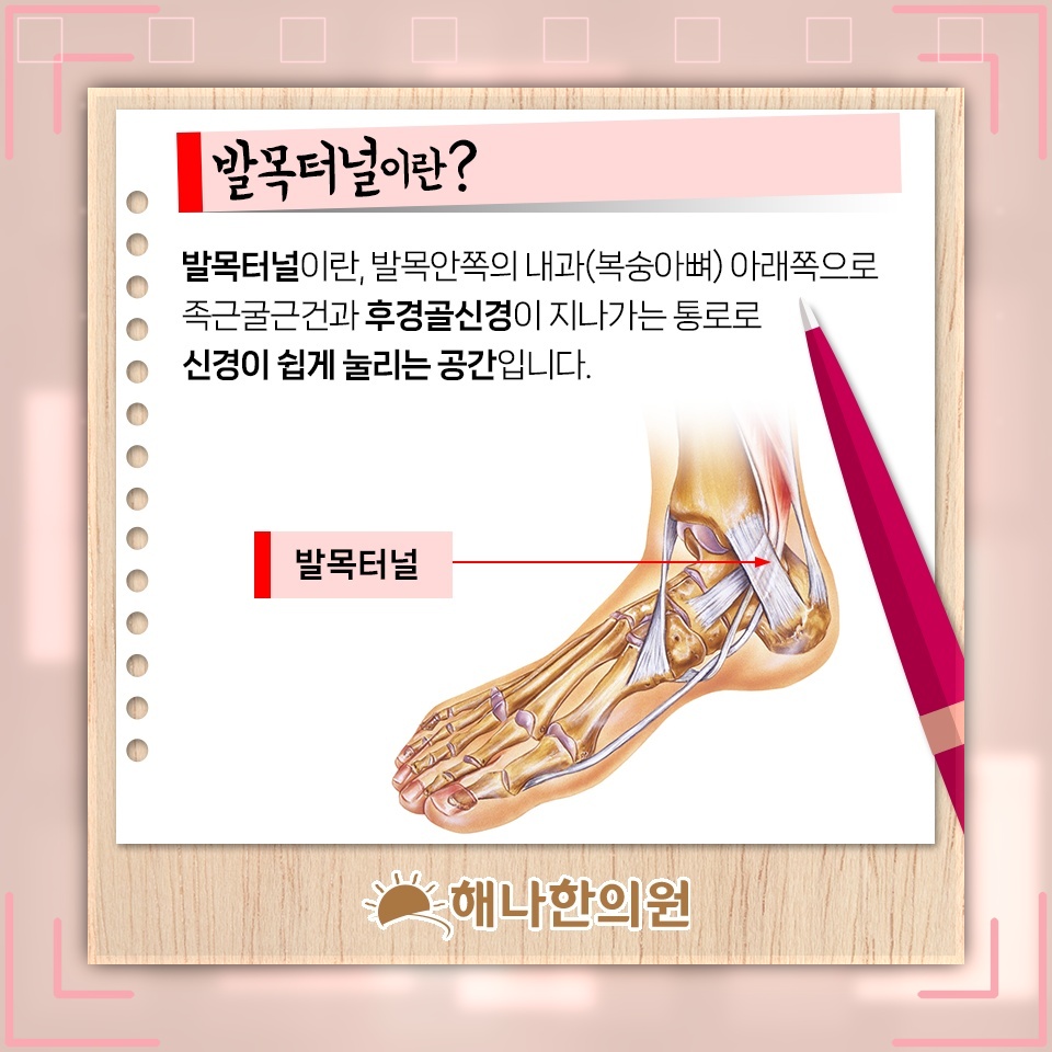 발목 안쪽 통증과 저림으로 살펴보는 발목터널증후군
