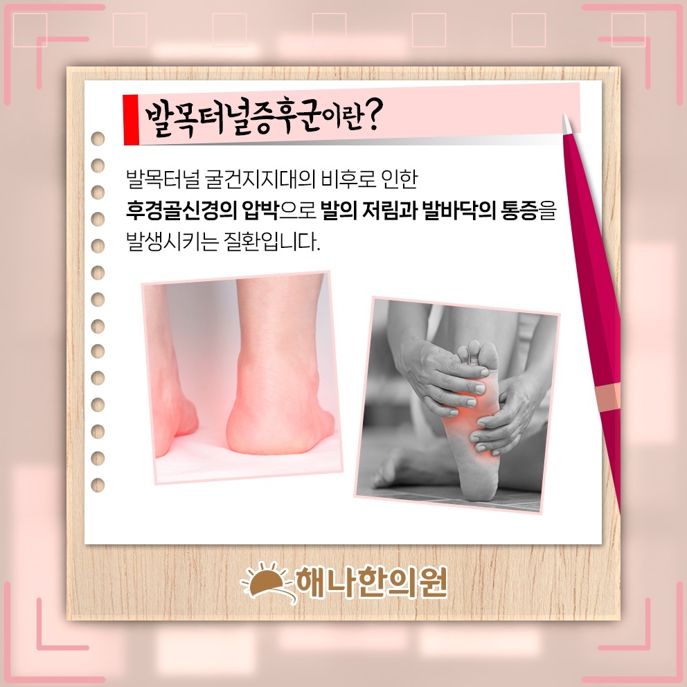 발목 안쪽 통증과 저림으로 살펴보는 발목터널증후군