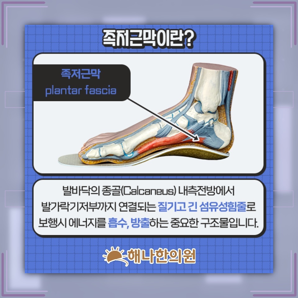 발바닥을 디딜 때 심해지는 족저근막염의 불편감