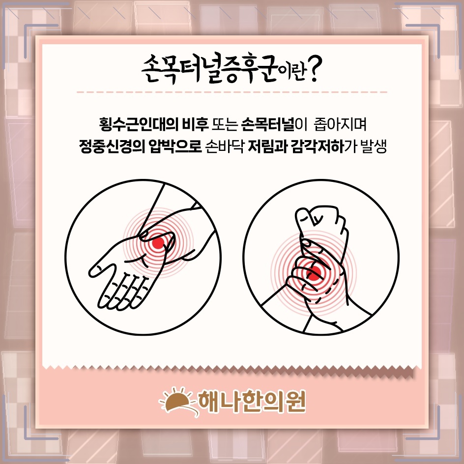 손목터널증후군 초기 증상, 비절개 치료를 살펴볼 때