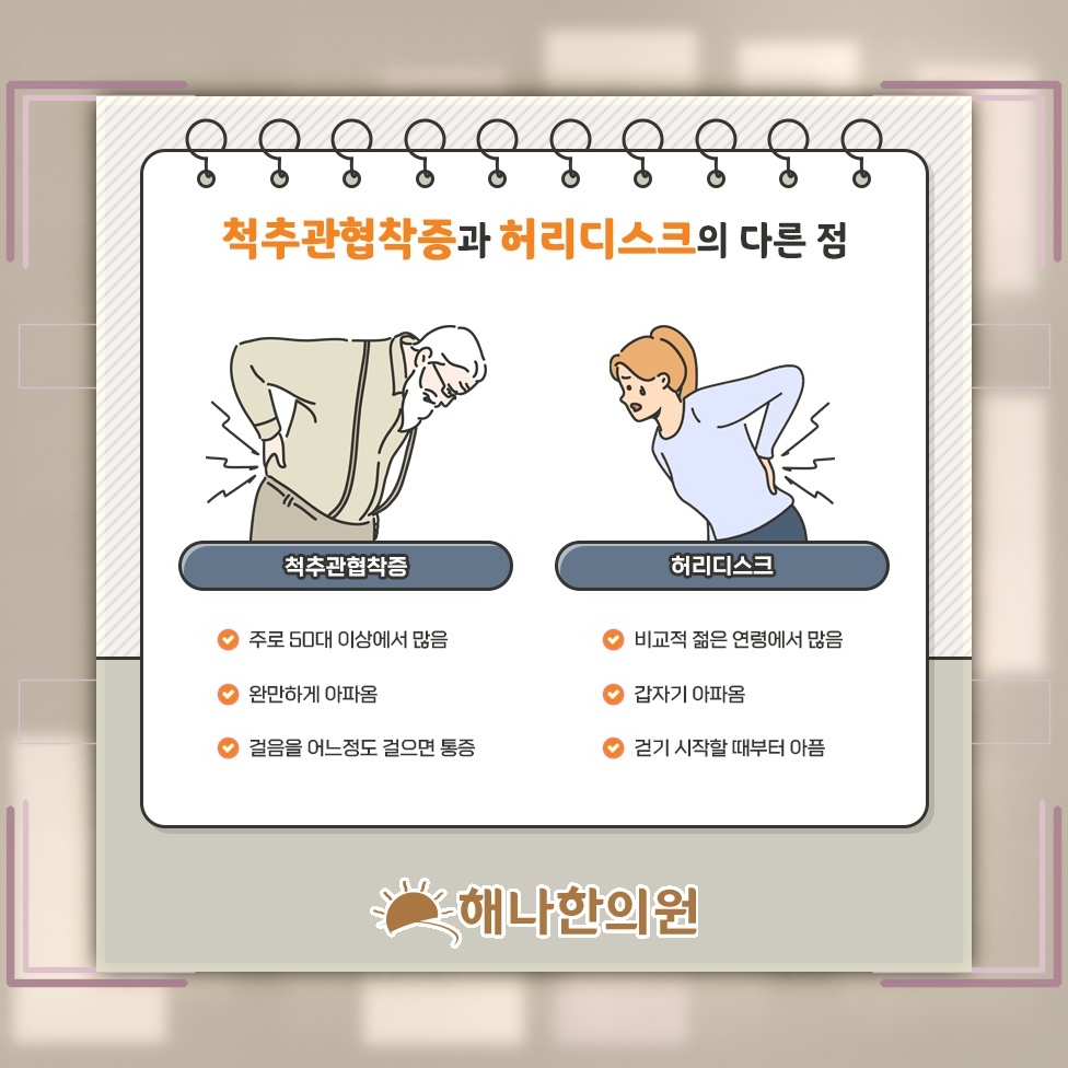 다리 저림과 힘 저하로 나타나는 척추관협착증 신경 증상