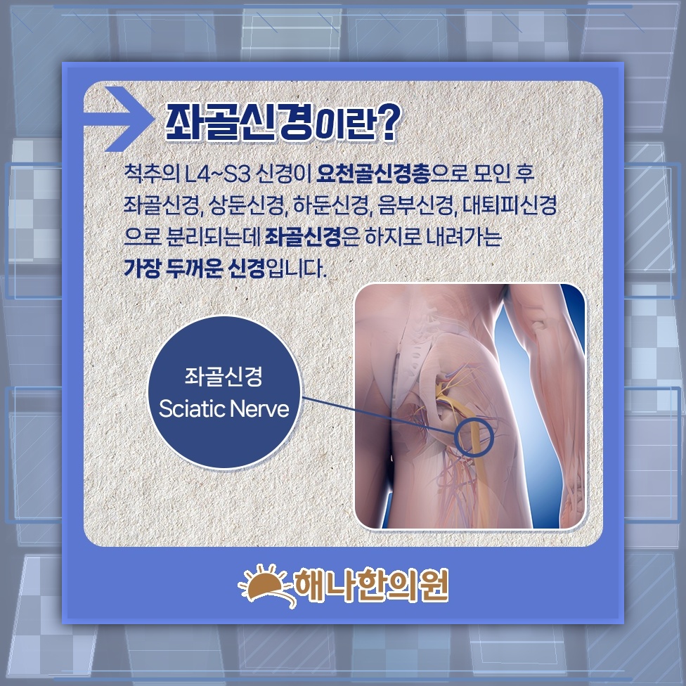 좌골신경통과 이상근증후군으로 살펴보는 골반 통증 양상