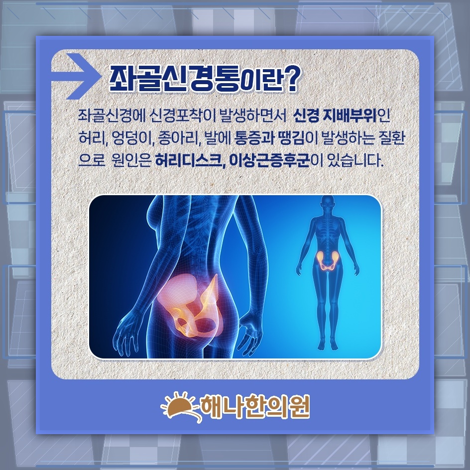 좌골신경통과 이상근증후군으로 살펴보는 골반 통증 양상