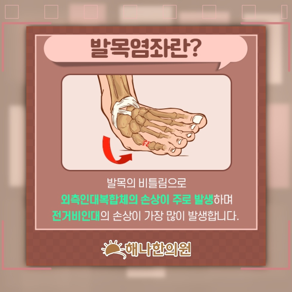 발목을 접질린 직후 나타나는 염좌의 주요 증상