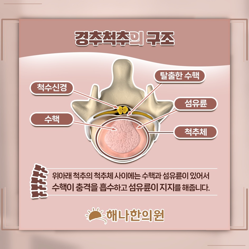 목디스크와 경추 정렬, 본래 자리에서 달라지는 변화